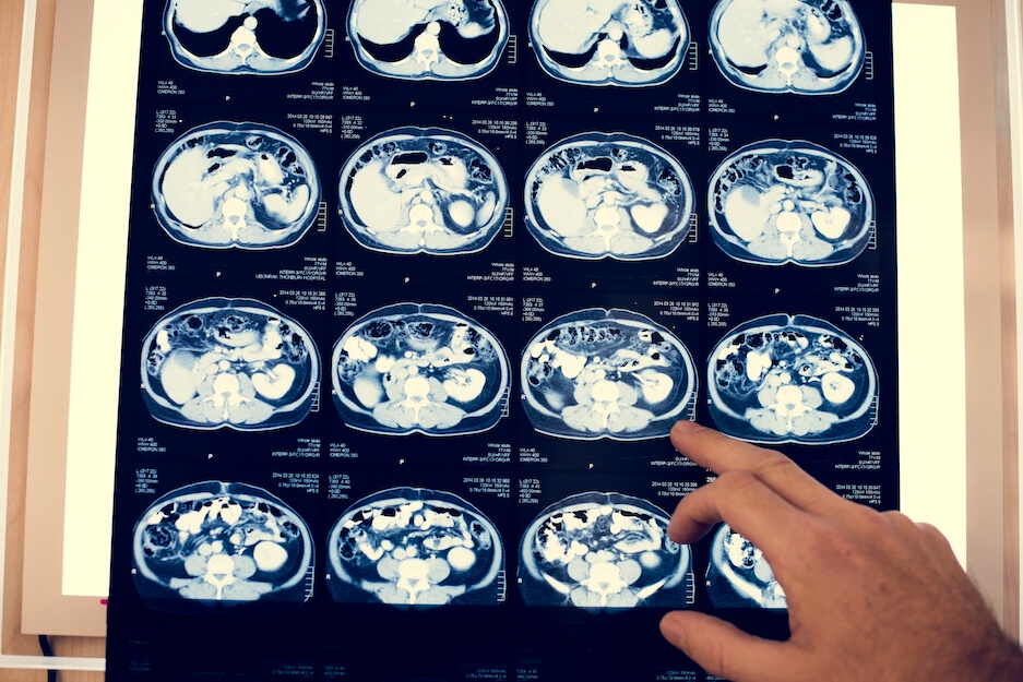 Brain-Scan-Alzheimers-Research-History